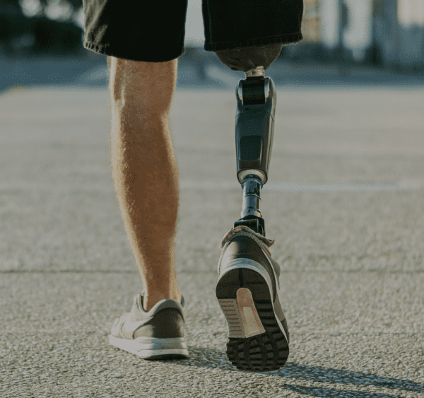 Limb Loss Awareness Month University Surgical Associates