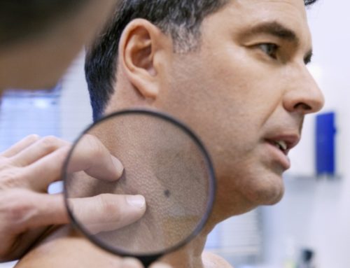 Surgical Expertise for Advanced Stage Melanoma